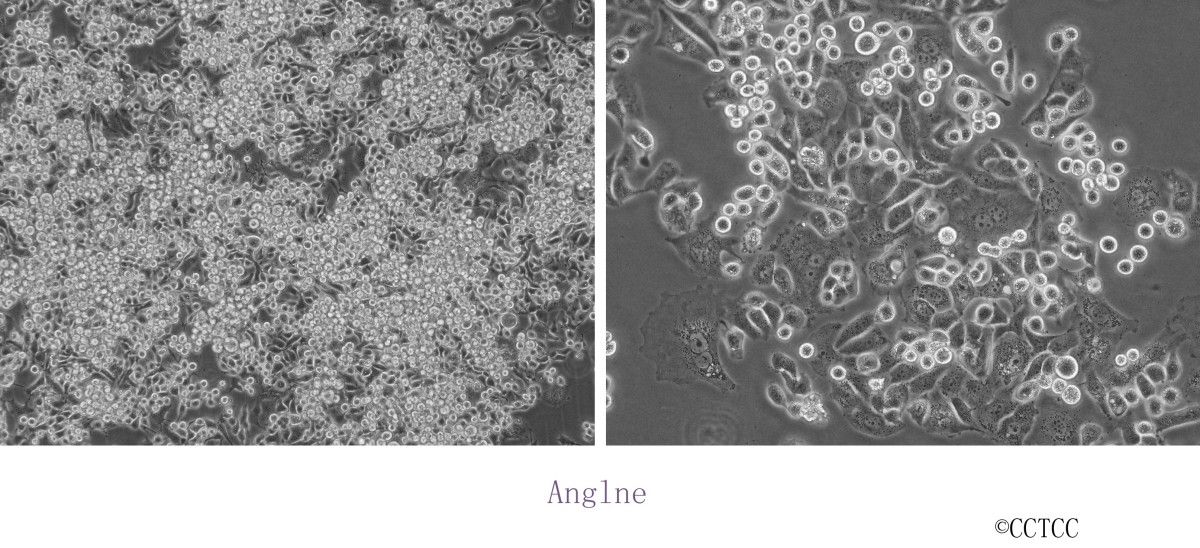 Anglne人卵巢癌细胞图片
