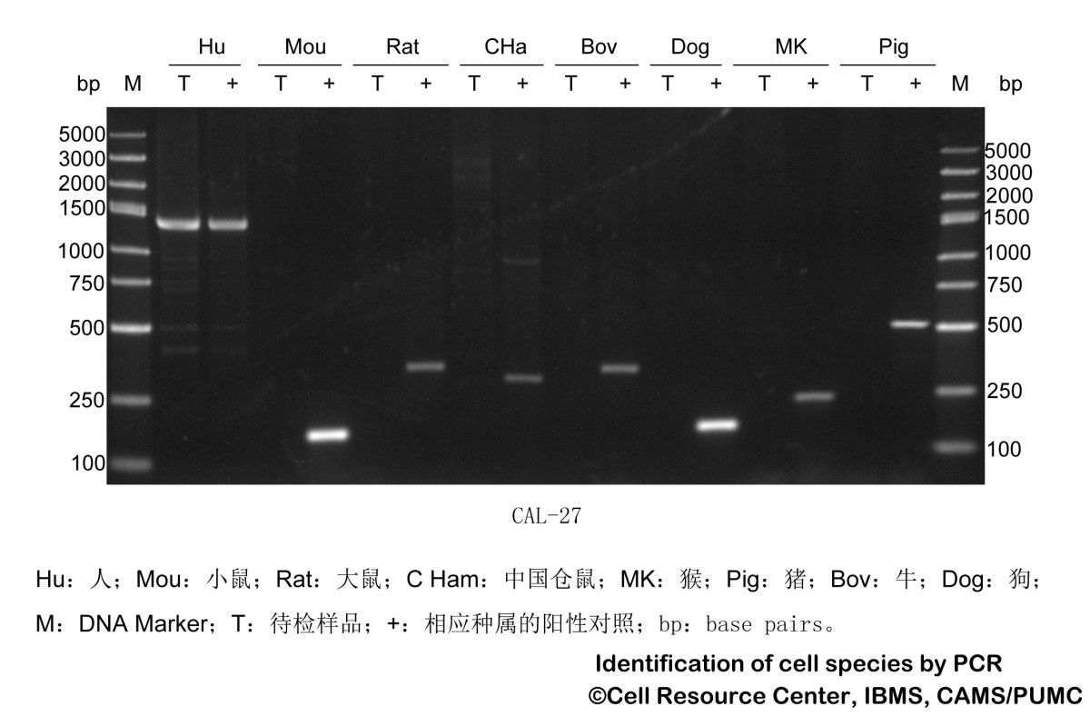 CAL-27人舌鳞癌细胞图片