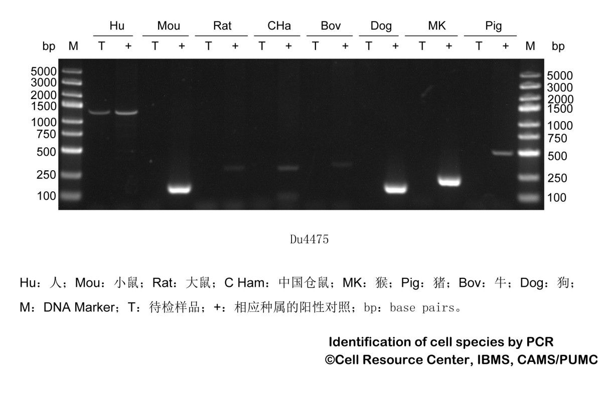 DU4475人乳腺上皮细胞图片