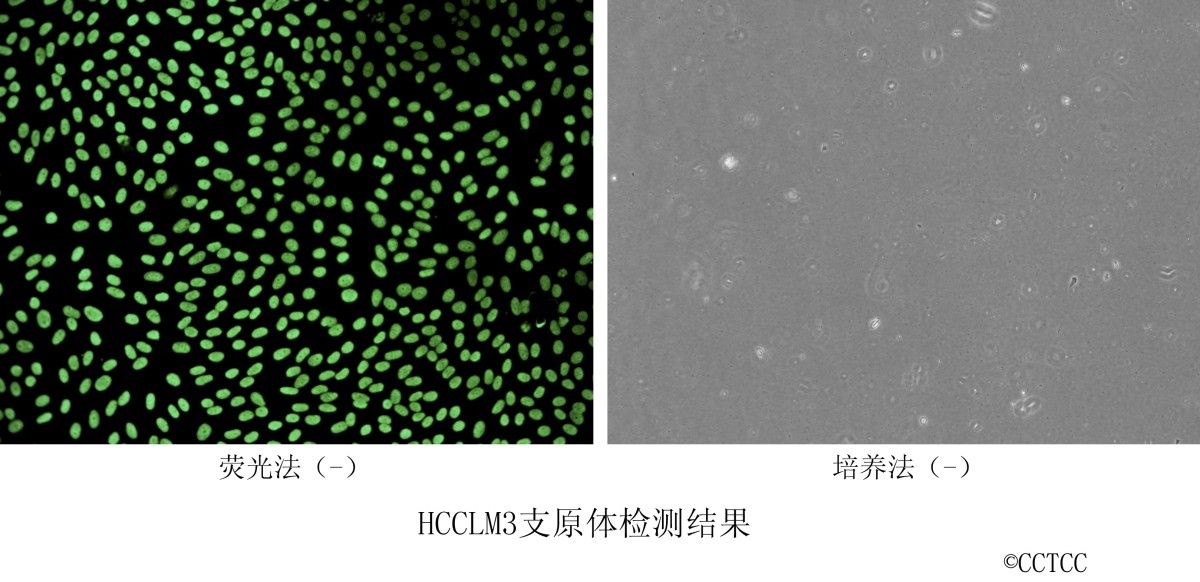 HCCLM3人肝癌细胞图片