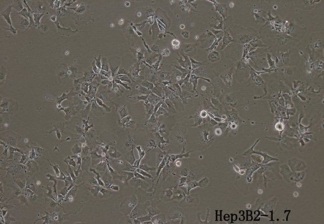 Hep-3B2.1-7人肝癌细胞图片