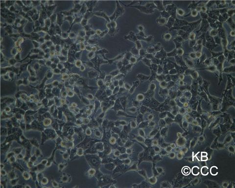 KB人口腔表皮样癌细胞图片