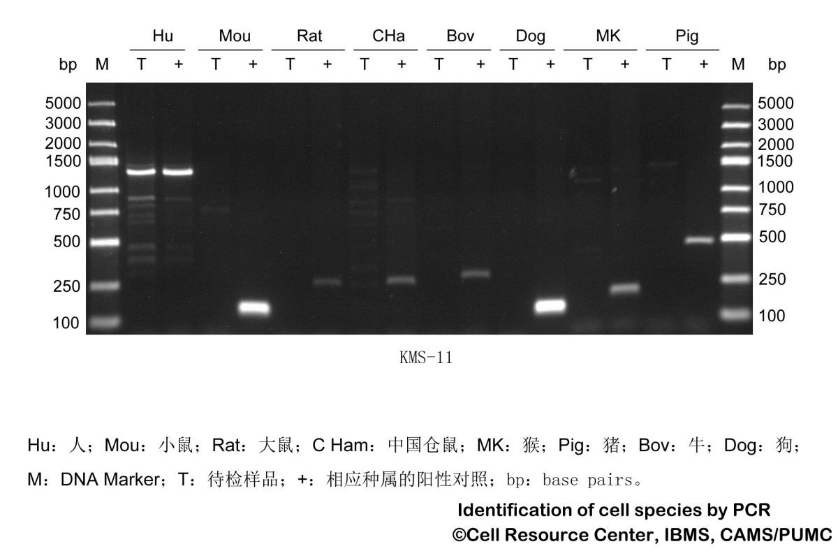 KMS-11人多发性骨髓瘤细胞图片