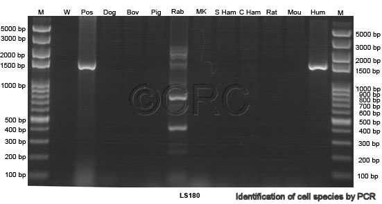 LS 180 (CL-187) [LS180]人结肠腺癌细胞图片