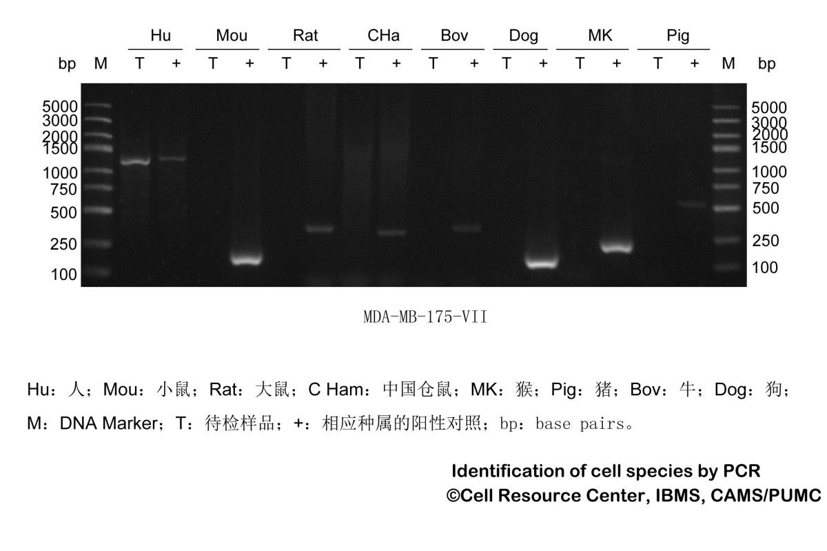 MDA-MB-175Ⅶ人乳腺导管癌细胞图片
