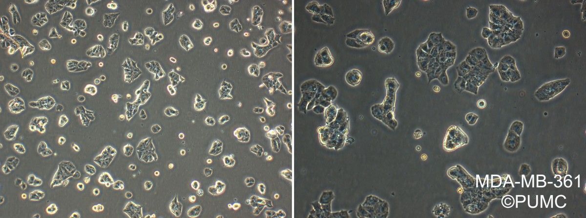 MDA-MB-361人乳腺癌细胞图片