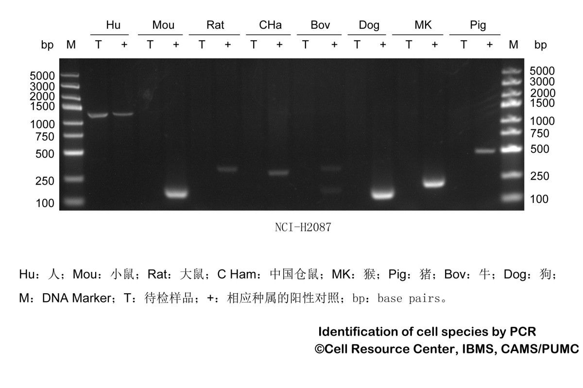 NCI-H2087人非小细胞肺腺癌细胞图片