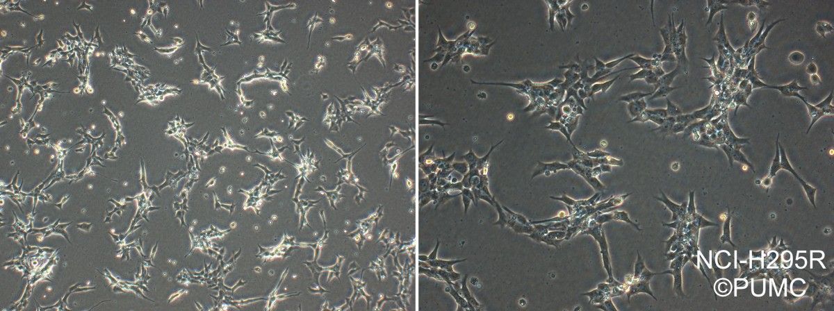 NCI-H295R人肾上腺皮质腺癌细胞图片