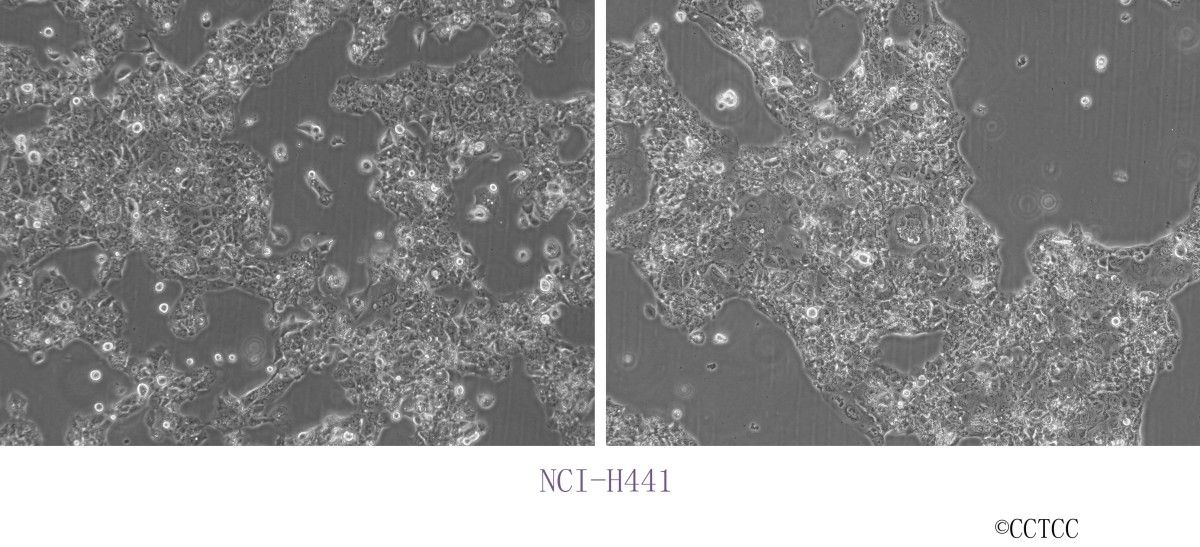 NCI-H441人肺腺癌细胞图片