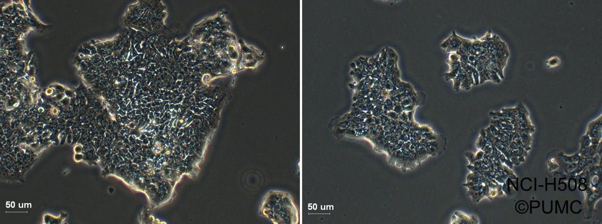 NCI-H508人结肠癌细胞图片