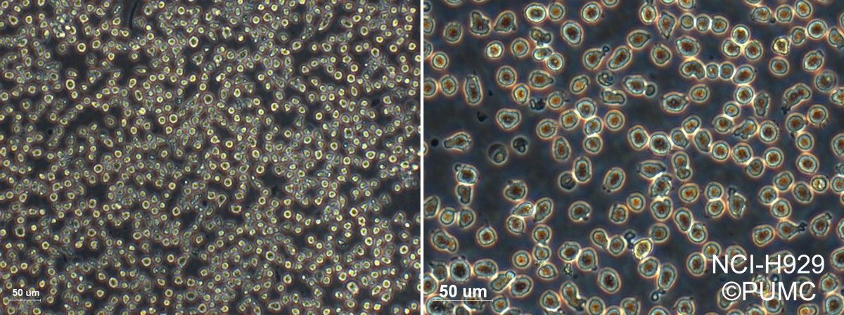 NCI-H929人浆细胞白血病细胞图片