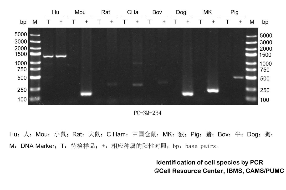 PC-3M-2B4人前列腺癌低转移细胞株图片