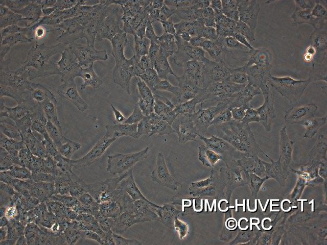 PUMC-HUVEC-T1 SV40T转化人脐静脉内皮细胞图片