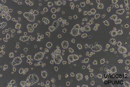 UACC812人乳腺导管瘤细胞图片