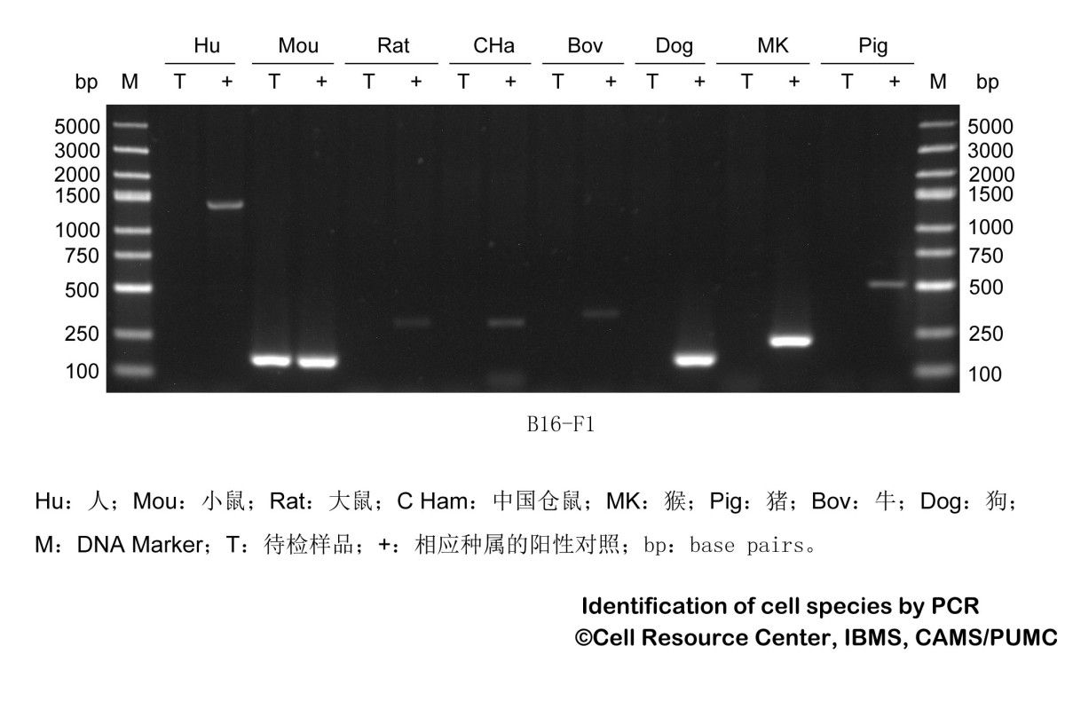 B16-F1小鼠黑色素瘤细胞图片